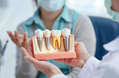 Dental Implants Image 1