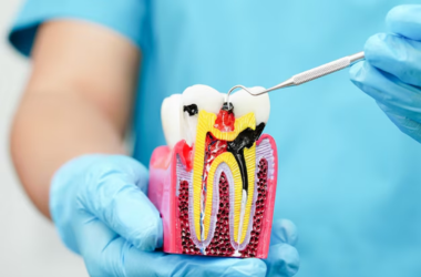 Dental Implants Image 1