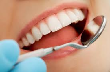Dental Implants Image 1