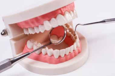 Dental Implants Image 1